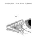 METHOD FOR DIAGNOSIS AND TREATMENT OF PROCESSING DIFFICULTIES, INTEGRATION PROBLEMS, IMBALANCES AND ABNORMAL POSTURES diagram and image