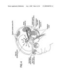 METHOD FOR DIAGNOSIS AND TREATMENT OF PROCESSING DIFFICULTIES, INTEGRATION PROBLEMS, IMBALANCES AND ABNORMAL POSTURES diagram and image