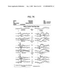 METHOD FOR DIAGNOSIS AND TREATMENT OF PROCESSING DIFFICULTIES, INTEGRATION PROBLEMS, IMBALANCES AND ABNORMAL POSTURES diagram and image