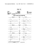 METHOD FOR DIAGNOSIS AND TREATMENT OF PROCESSING DIFFICULTIES, INTEGRATION PROBLEMS, IMBALANCES AND ABNORMAL POSTURES diagram and image