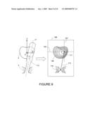 Method and device for real time mechanical imaging of prostate diagram and image