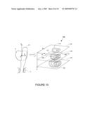 Method and device for real time mechanical imaging of prostate diagram and image