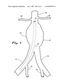 Sealable endovascular implants and methods for their use diagram and image