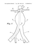 Sealable endovascular implants and methods for their use diagram and image
