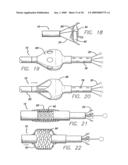 EXPANDABLE CATHETER HAVING TWO SETS OF ELECTRODES diagram and image