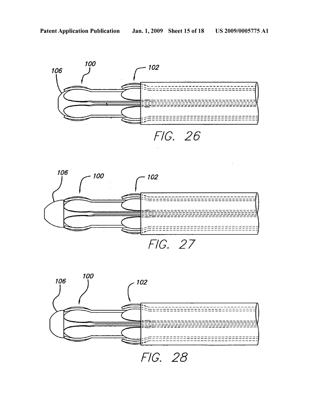 EXPANDABLE CATHETER HAVING TWO SETS OF ELECTRODES - diagram, schematic, and image 16