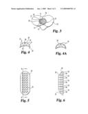 Intramedullary Canal Diameter Reducer diagram and image