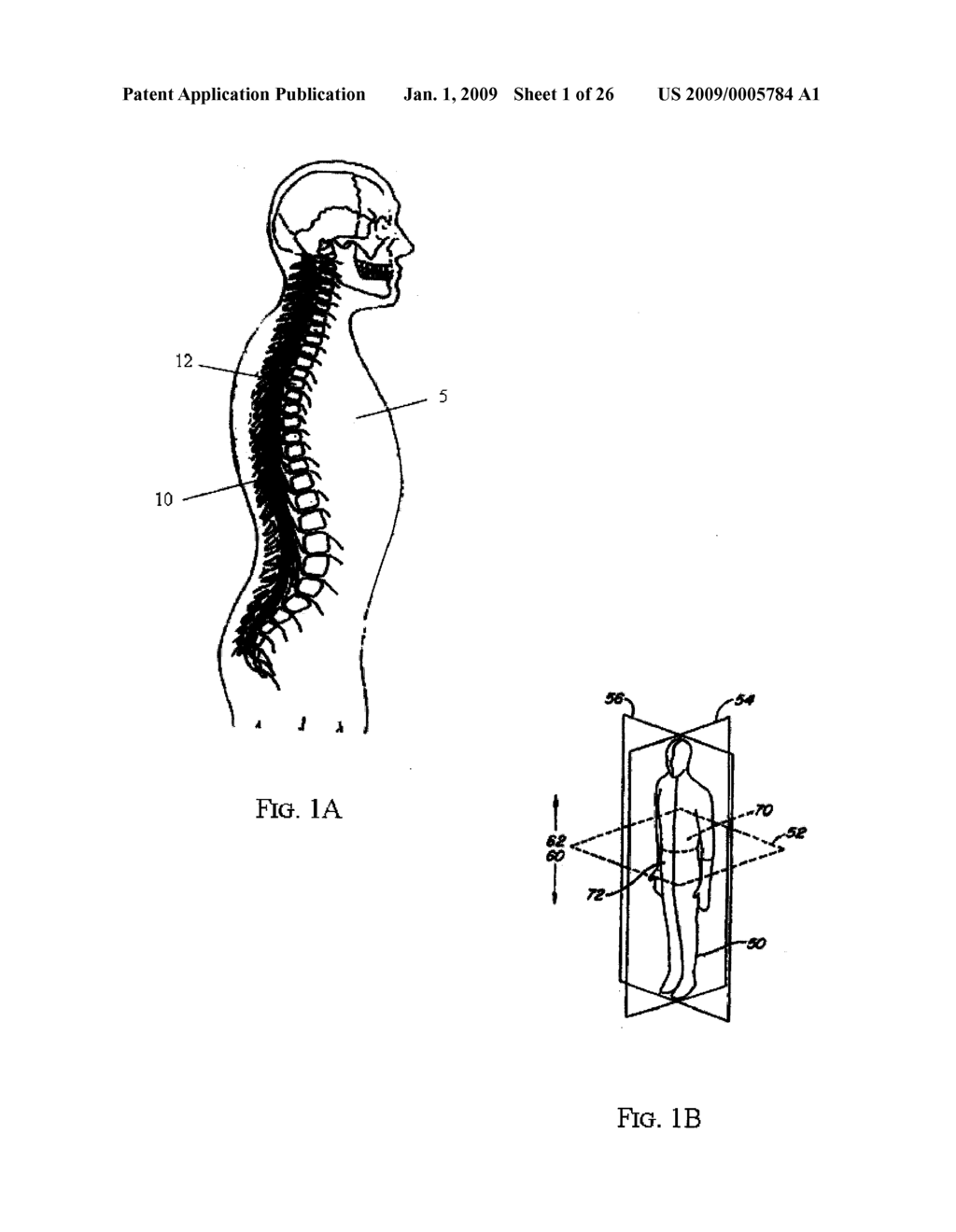 SPINAL IMPLANT DISTRACTOR/INSERTER - diagram, schematic, and image 02