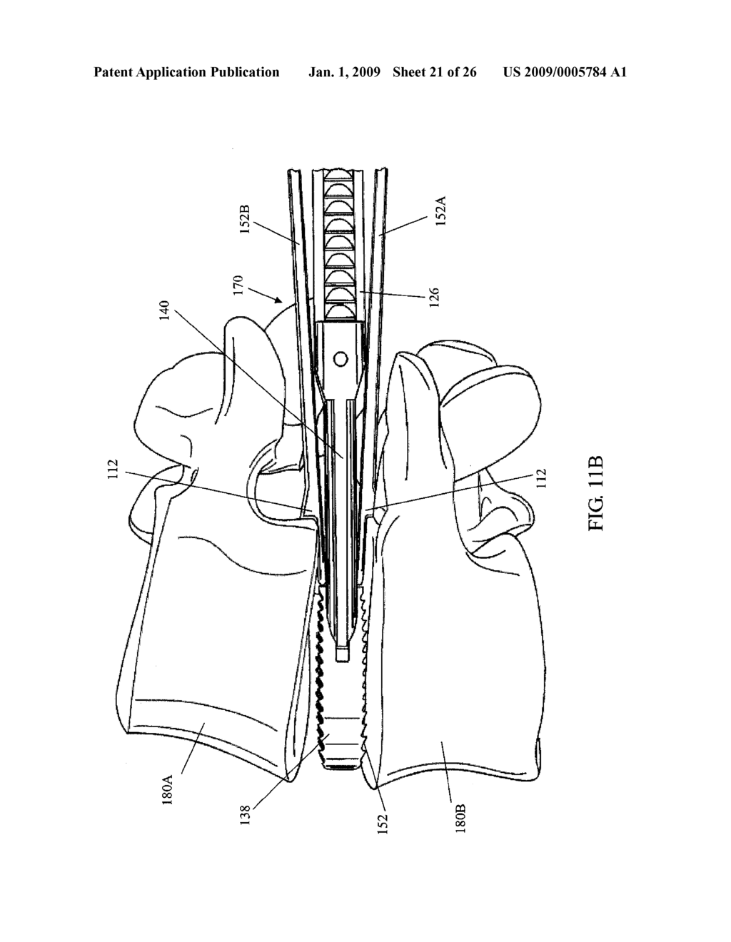 SPINAL IMPLANT DISTRACTOR/INSERTER - diagram, schematic, and image 22