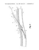 Vascular Suturing Device diagram and image