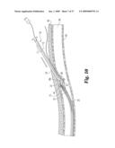 Vascular Suturing Device diagram and image