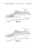 Vascular Suturing Device diagram and image