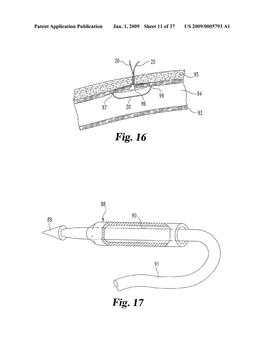 Vascular Suturing Device - diagram, schematic, and image 12