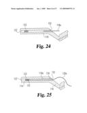 Vascular Suturing Device diagram and image