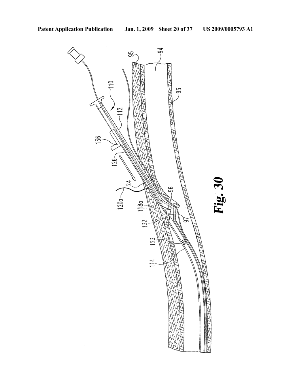 Vascular Suturing Device - diagram, schematic, and image 21