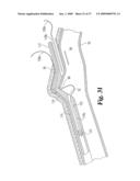 Vascular Suturing Device diagram and image