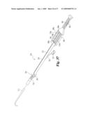 Vascular Suturing Device diagram and image