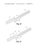 Vascular Suturing Device diagram and image