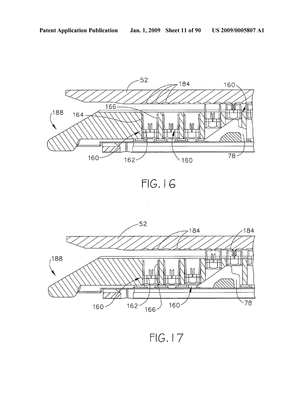 Surgical staple having a slidable crown - diagram, schematic, and image 12