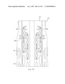 Surgical staple having a slidable crown diagram and image