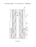 Surgical staple having a slidable crown diagram and image