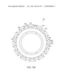 Surgical staple having a slidable crown diagram and image