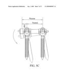 Flexible Spine Stabilization System diagram and image