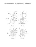 Flexible Spine Stabilization System diagram and image