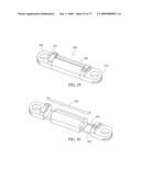 Flexible Spine Stabilization System diagram and image