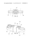 Flexible Spine Stabilization System diagram and image