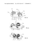 Flexible Spine Stabilization System diagram and image