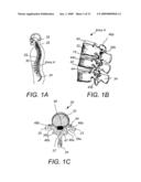 DYNAMIC FACET REPLACEMENT SYSTEM diagram and image