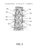 DYNAMIC FACET REPLACEMENT SYSTEM diagram and image