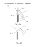 DYNAMIC FACET REPLACEMENT SYSTEM diagram and image