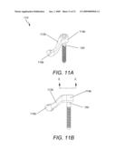 DYNAMIC FACET REPLACEMENT SYSTEM diagram and image