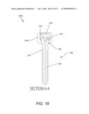 DYNAMIC FACET REPLACEMENT SYSTEM diagram and image