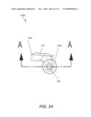 DYNAMIC FACET REPLACEMENT SYSTEM diagram and image