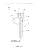 DYNAMIC FACET REPLACEMENT SYSTEM diagram and image