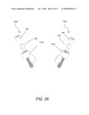 DYNAMIC FACET REPLACEMENT SYSTEM diagram and image