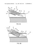 Methods and Devices for Placing a Conduit in Fluid Communication with a Target Vessel diagram and image