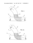 Methods and Devices for Placing a Conduit in Fluid Communication with a Target Vessel diagram and image