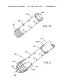 Methods and Devices for Placing a Conduit in Fluid Communication with a Target Vessel diagram and image