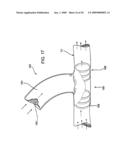 Methods and Devices for Placing a Conduit in Fluid Communication with a Target Vessel diagram and image