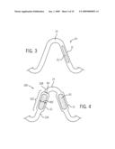 Integration Of Markers Into Bar Arms diagram and image