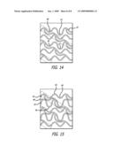 ENDOPROSTHESES FOR PERIPHERAL ARTERIES AND OTHER BODY VESSELS diagram and image