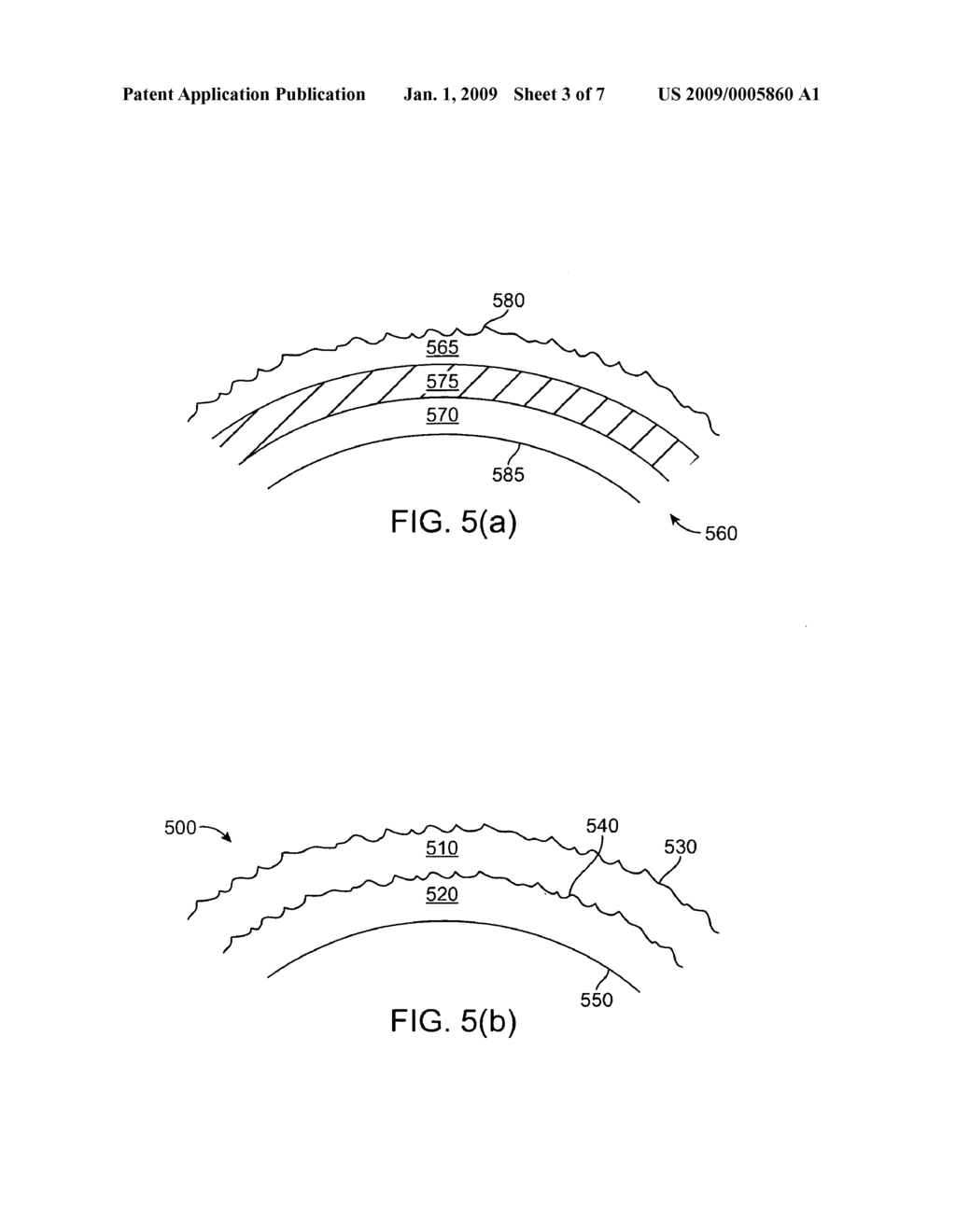 Method to fabricate a stent having selected morphology to reduce restenosis - diagram, schematic, and image 04