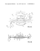 Post-Implant Accommodating Lens Modification diagram and image