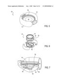 Post-Implant Accommodating Lens Modification diagram and image