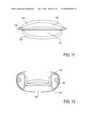 Post-Implant Accommodating Lens Modification diagram and image