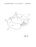 Post-Implant Accommodating Lens Modification diagram and image